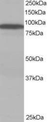 NB100-1397 - VPS35 / MEM3