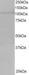 NB100-1378 - XPO7 / Exportin-7