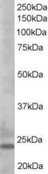 NB100-1440 - Bcl-2-like 11