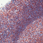 NB600-546 - Sm (Smith Antigen)