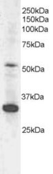 NB100-896 - TMPRSS5 / Spinesin