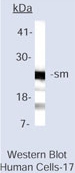 NB600-546 - Sm (Smith Antigen)