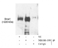 NB100-199 - BRCA1 / RNF53