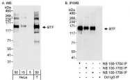 NB100-1705 - BCLAF1 / BTF