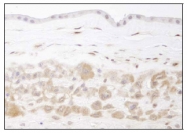NB100-1747 - Visfatin / NAMPT