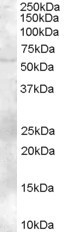 NB100-1317 - ZBTB32 / FAZF
