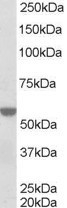 NB100-1466 - RXR-alpha / RXRA