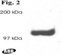 NB300-546 - DLG2 / PSD93