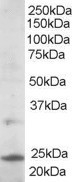 NB300-841 - UBE2L3 / UBCH7