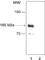 NB100-2146 - HDAC7