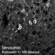 NB100-2052 - Serotonin