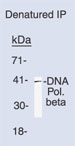 NB600-1025 - DNA polymerase beta