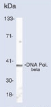 NB600-1025 - DNA polymerase beta
