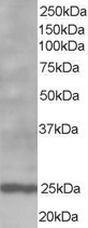 NB300-900 - Bcl-2