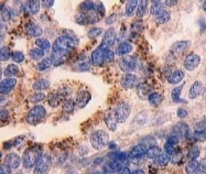 NB200-562 - Mucin-16 / CA125