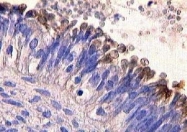 NB200-562 - Mucin-16 / CA125