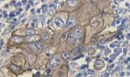 NB200-562 - Mucin-16 / CA125