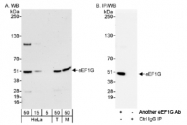 NB100-2263 - EEF1G