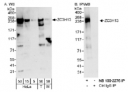 NB100-2276 - ZC3H13