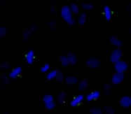 NB100-2371 - Aurora kinase A