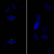 NB100-2371 - Aurora kinase A