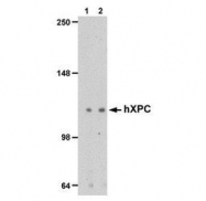 NB100-477 - XPC / XPCC