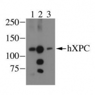 NB100-477 - XPC / XPCC