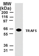 NB600-1107 - TRAF5 / RNF84