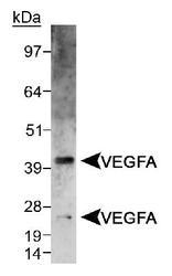 NB100-2381 - VEGF-A