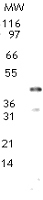 NB200-616 - DNMT2 / TRDMT1