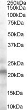 NB100-2468 - VPS25