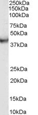 NB100-2438 - VPS37C