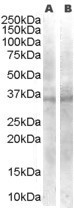 NB100-1006 - WNT4