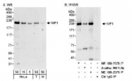 NB100-2579 - ZNF335