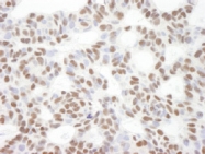 NB100-2600 - Bcl-11B