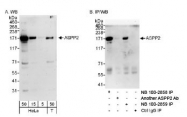 NB100-2859 - TP53BP2