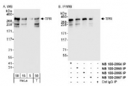 NB100-2864 - TPR