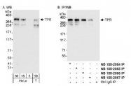 NB100-2865 - TPR