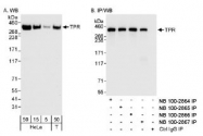NB100-2867 - TPR