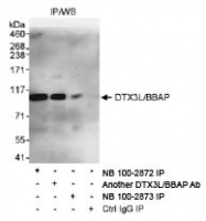 NB100-2872 - DTX3L / BBAP