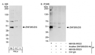 NB100-55322 - ZRANB2