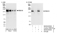 NB100-55330 - RBM16