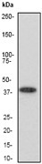 NB110-55480 - Aurora kinase B