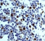 NB110-55480 - Aurora kinase B