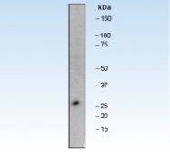 NB110-55551 - Bcl-2