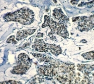 NB110-55551 - Bcl-2