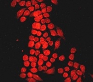 NB110-55552 - Bcl-2-like 5