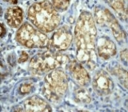 NB110-55556 - Beclin-1