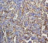 NB110-55558 - B-cell linker protein / BLNK