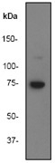 NB110-55559 - BTK